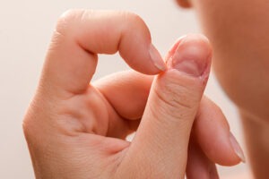 Hypnosis Solves Biting Nails and Picking Skin